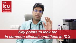 Key Concepts & Points To Know in Common ICU Conditions by a new doctor or nurse on first day in ICU