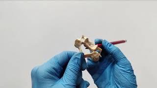 CERVICAL VERTEBRAE | CHARACTERISTICS OF A TYPICAL CERVICAL VERTEBRA | Dr Lakshmi Nalinakshan