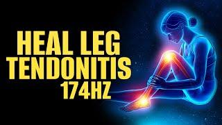 Heal Leg Tendonitis | Get Relief from Leg Muscles Pain | Speed Recovery | 174hz Pain Relief