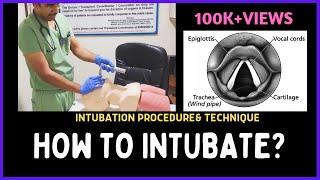 HOW TO INTUBATE? INTUBATION PROCEDURE & TECHNIQUE