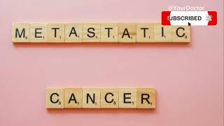 Cancer Awareness: Early Detection Can Save Lives | YourDoctor"