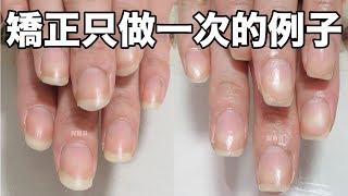 Example of problem nail correction only once / Correcting nails - Do a gel can solve the problem
