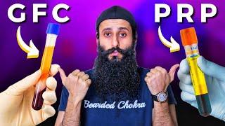 PRP vs GFC Treatment For Hair Growth - The Truth | Bearded Chokra