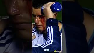 CR7 MATANYA PECAH LANGSUNG AUTO BALAS DENDAM!!!