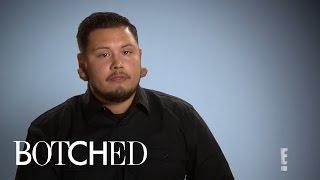 "Botched" Patient Battles With Keloids on Earlobes | E!