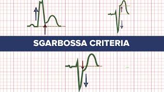 Sgarbossa Criteria - MEDZCOOL