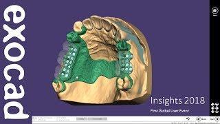 INSIGHTS 2018: PartialCAD Case Demonstration - Bridge with attachments and partial Part II