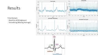 Signalprocessing ECG group 2