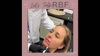 RBF - Quick, easy fix with that will make you look happier with a resting face!