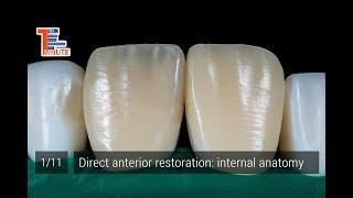 Direct anterior restoration: internal anatomy.