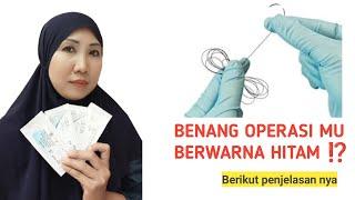 REVIEW BENANG OPERASI WARNA HITAM || Di serap atau Tidak ya⁉️