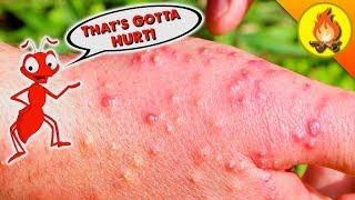 HANDS get DESTROYED by Fire Ants!