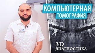 Компьютерная томография зубов (КТ). 3D Диагностика. Рентген зубов