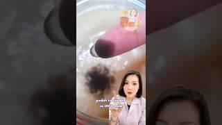 MOLD pada kombucha itu APA??? Bahaya kah? #kombucha #Scoby