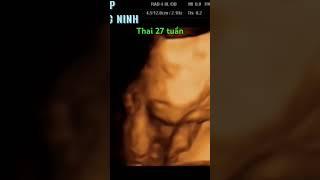 27 weeks pregnant on ultrasound/ Thai 27 tuần -Siêu âm Thảo Hiệp- Yên Phụ Yên Phong Bắc Ninh