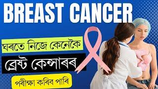 স্তনৰ কেন্সাৰ বা BREAST CANCER ত কি কি লক্ষণে দেখা দিব পাৰে || Dr. Ponkhi Sharma  -PT