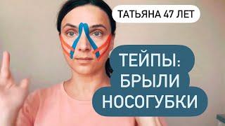 Тейпы: брыли, носогубки