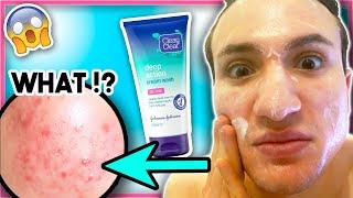 I tried Clean and Clear ACNE CREAM face wash for ONE WEEK!