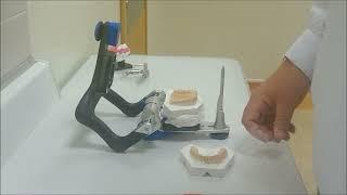 Artex / SAM Articulator