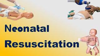 Neonatal Resuscitation | TOACS & OSCE Station