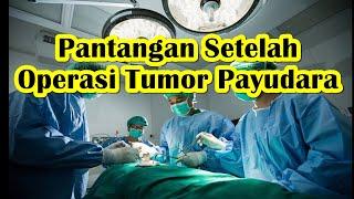 Makanan Yang Tidak Boleh dimakan Setelah Operasi Tumor Payudara