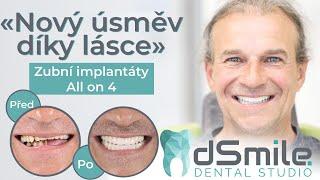 How does dental implantation work? Permanent teeth in Prague