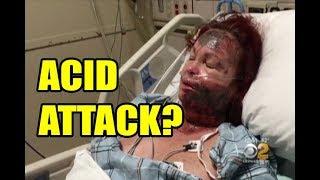 Woman Sprays Her Own Face With Acid So She Can Blame A Black Person!