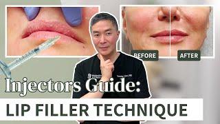 How to Create Beautiful Lips With Dermal Fillers | Injector’s Guide