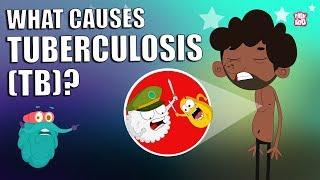 TUBERCULOSIS | What Is Tuberculosis | TB - Tuberculosis Disease | The Dr Binocs Show | Peekaboo Kidz