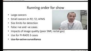 ICIS 2021 Siemens Symposium: Using Siemens AI for Prostate Cancer Detection by Prof. Anwar Padhani