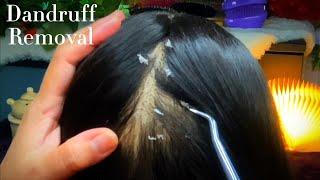 ASMR ] Sis Checks You Itchy Scalp Dandruff Removal | Scalp Scratching | Hair Brushing | No Talking 