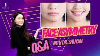 Dr. Shuyan Explains Facial Asymmetry: Causes, Treatments, and Solutions | RJ CLINIC