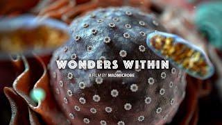 MadMicrobe WONDERS WITHIN