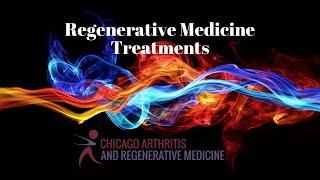 Regenerative Medicine Treatments To Avoid Surgery  | Chicago Arthritis