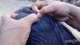 #oil hair#lice nit picking #by hands#most requested video #subsribe #pls