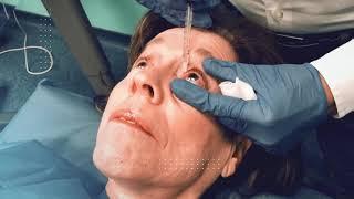 Treatment of a mild tear duct obstruction with local anesthesia