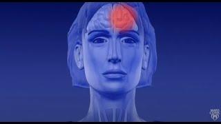 Learn About Migraine Aura