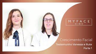 MyFace Clinic - Testemunho Vanessa e Rute - Parte 1