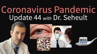 Coronavirus Pandemic Update 44: Loss of Smell & Conjunctivitis in COVID-19, Is Fever Helpful?