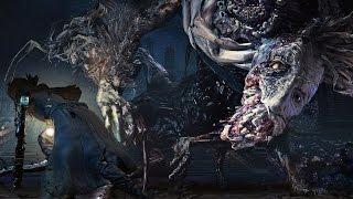 Bloodborne: Ludwig the Accursed, Holy Blade Boss Fight (1080p)