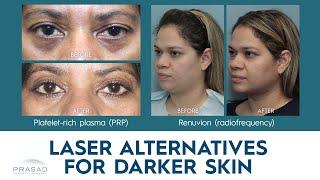 Laser Treatment Alternatives for Darker Skin