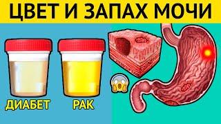 О чем расскажут ЦВЕТ и ЗАПАХ МОЧИ? Срочно проверьте свою МОЧУ! Сигналы серьезных болезней!