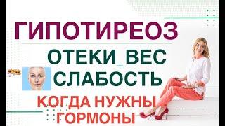  СЛАБОСТЬ ОТЕКИ НАБОР ВЕСА- ГИПОТИРЕОЗ: КОГДА ВВОДИТЬ ГОРМОНЫ Врач эндокринолог Ольга Павлова