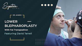 David Terrell - Lower Blepharoplasty with Fat Transposition at Signature Clinic