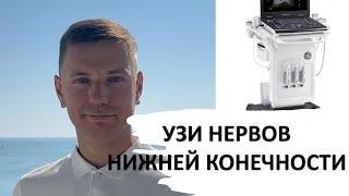 УЗИ НЕРВОВ НИЖНЕЙ КОНЕЧНОСТИ #узи #anatomy #ultrasound #нервы