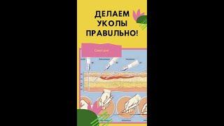 Как делать внутримышечный укол в ягодицу. Как делать уколы в ягодичную мышцу. Укол внутримышечный