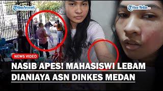 ASN Dinkes Medan Aniaya Mahasiswi, Sudah 9 Bulan Pelaku Masih Berkeliaran
