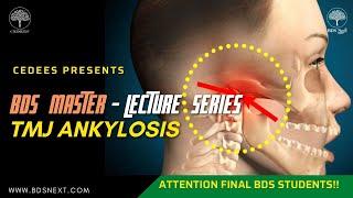 TMJ ANKYLOSIS  for Final BDS  - Cedees BDS MASTER Lecture Series .