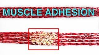 Muscle Adhesion Model