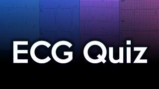 ECG Quiz Challenge